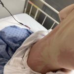 アナフィラキシーで入院した中川翔子さんが入院中の裸を公開 （画像あり）