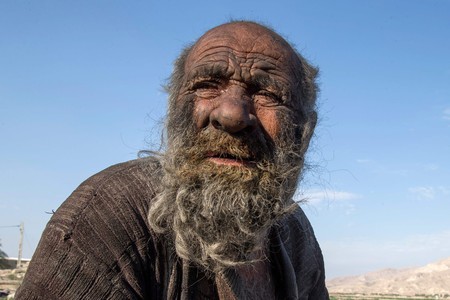 イランの「世界で最も汚い男」が94歳で死去  半世紀以上入浴せずも、数か月前に風呂に入れられていた
